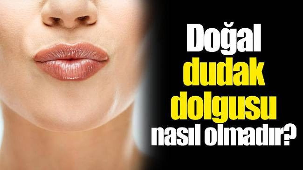 Dudak Dolgusu Yaptırırken Bunlara Dikkat !