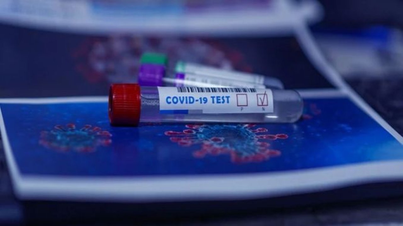 E-Devlet Koronavirüs Test Sonucu Sorgulama Nasıl Yapılır?