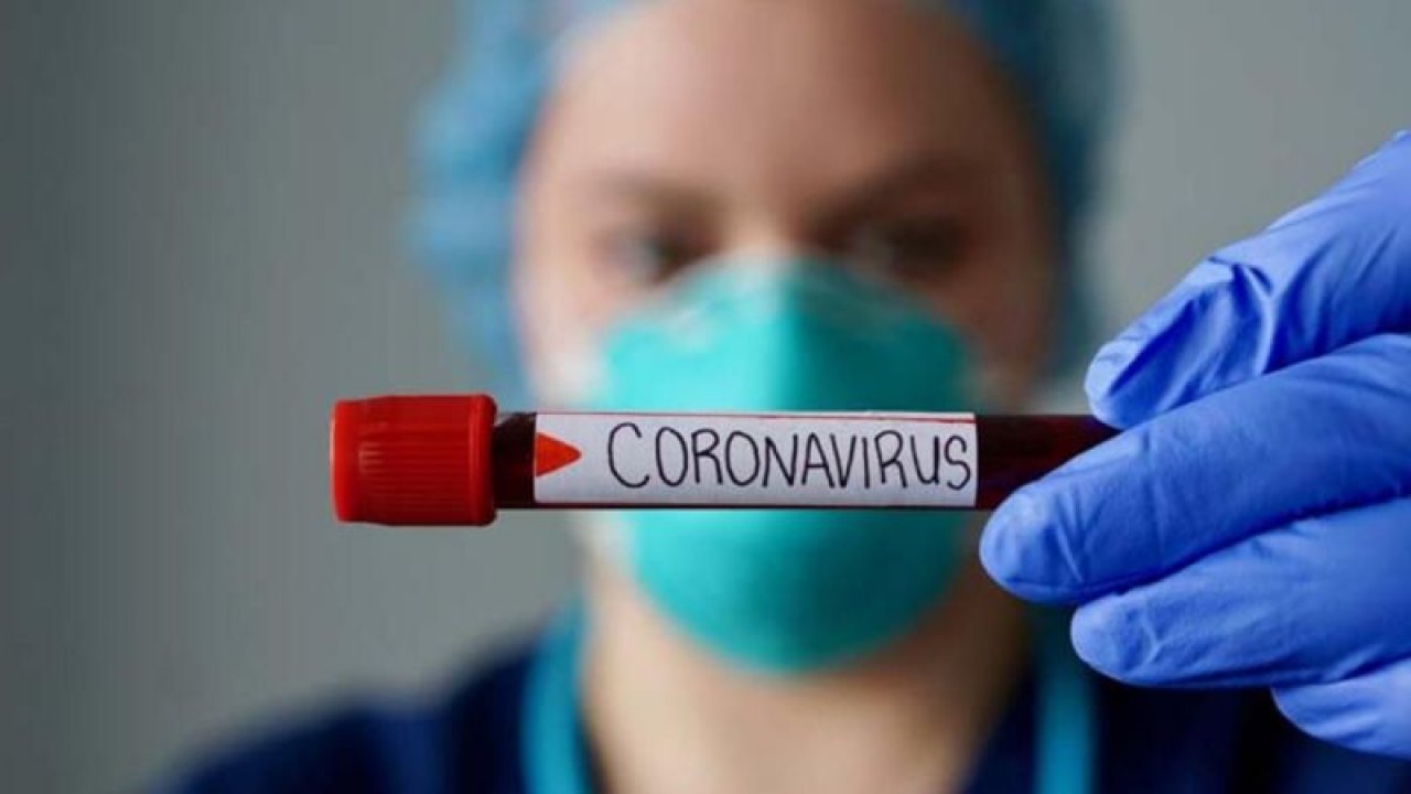 Ankara'da Koronavirüste Bugüne Kadar Yapılmış En Yanlış Bilgilendirme! Türk Doktorlar Çalışma Yapınca Tüm Gerçekler Ortaya Çıktı!