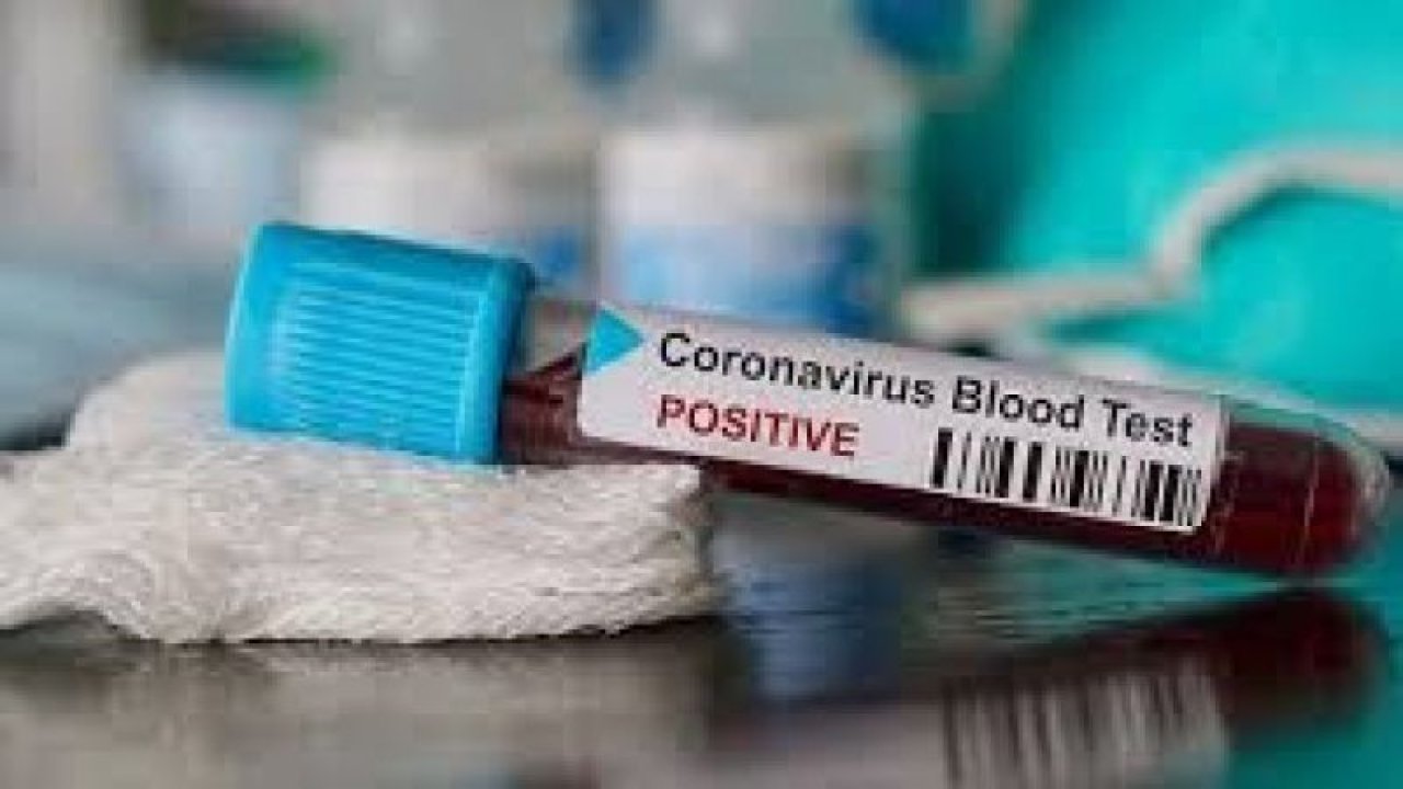 Koronavirüste son durum! Dünya genelinde vaka sayısı ve can kaybı kaç oldu? 24 Kasım 2020