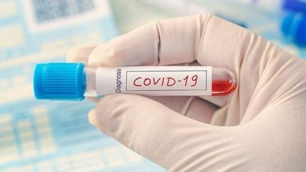 Ankara Koronavirüs İçin Tehlike Çanlarını Çalıyor! Vaka Sayısı 30 Bine Dayandı! Uzmanlar Çok Ciddi Açıklamalarını Duyurdu! “Her An Hasta Olabilirsiniz!”