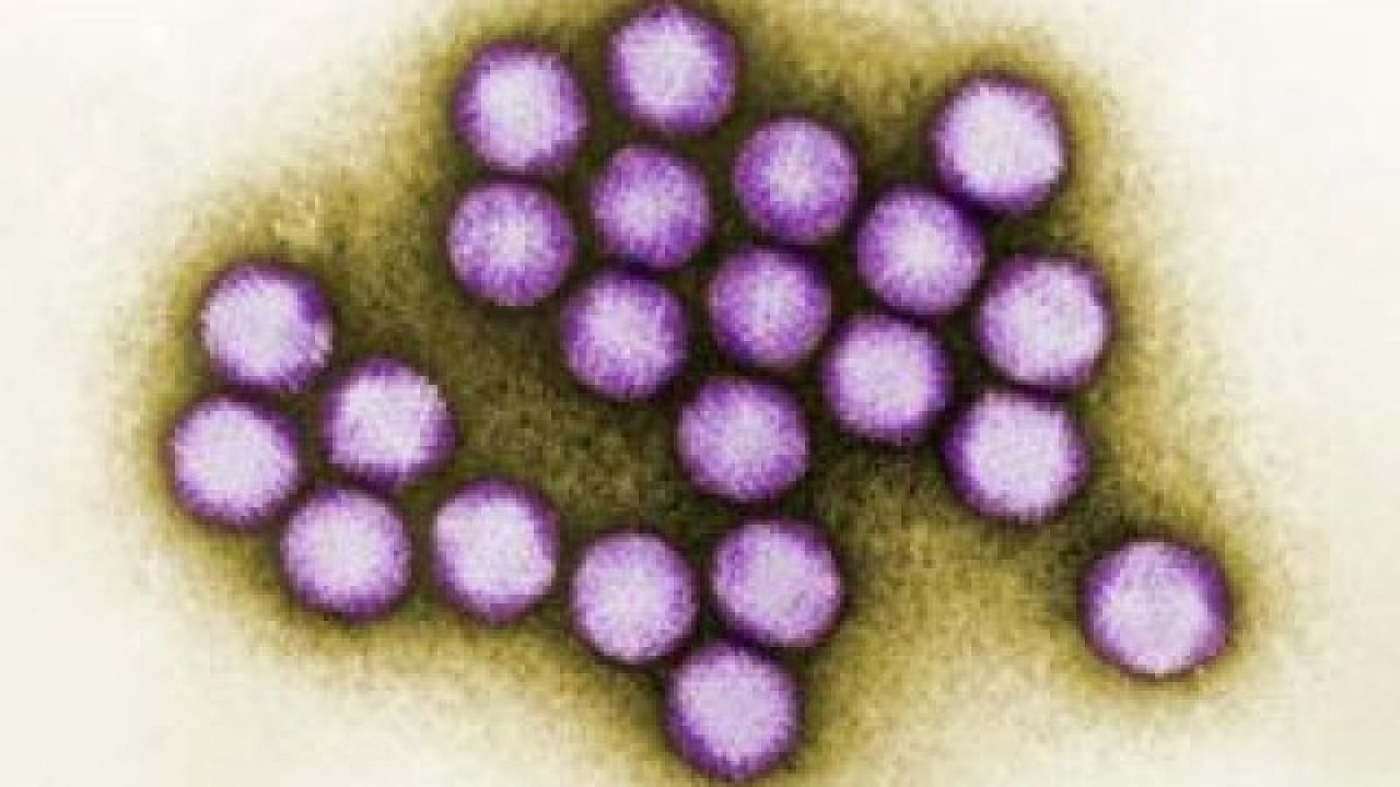 Korona Kadar Tehlikeli Adenovirüs uyarısı: Koronavirüs kadar hızlı yayılıyor! İşte belirtileri