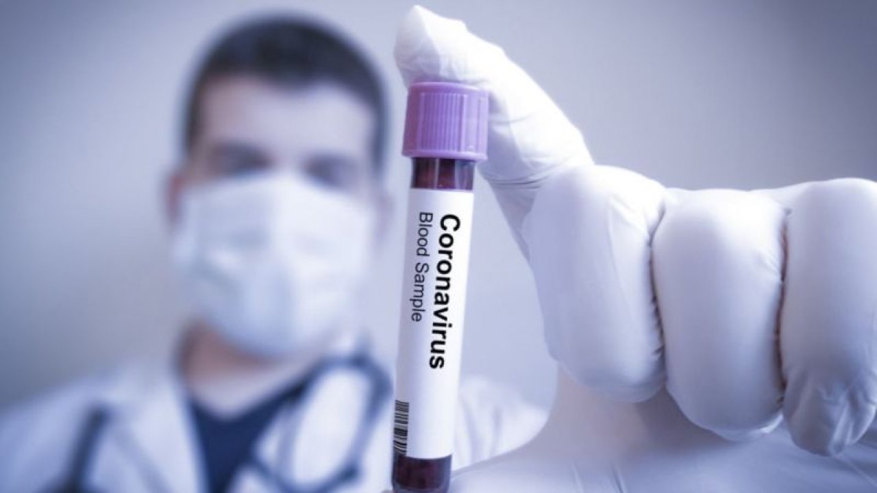 Koronavirüste son durum! Dünya genelinde vaka sayısı ve can kaybı kaç oldu? 30 Kasım 2020