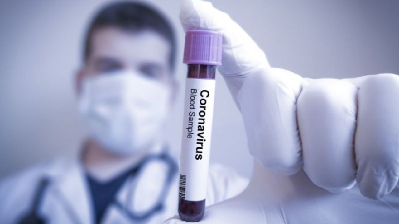 Koronavirüste son durum! Dünya genelinde vaka sayısı ve can kaybı kaç oldu? 17 Aralık 2020