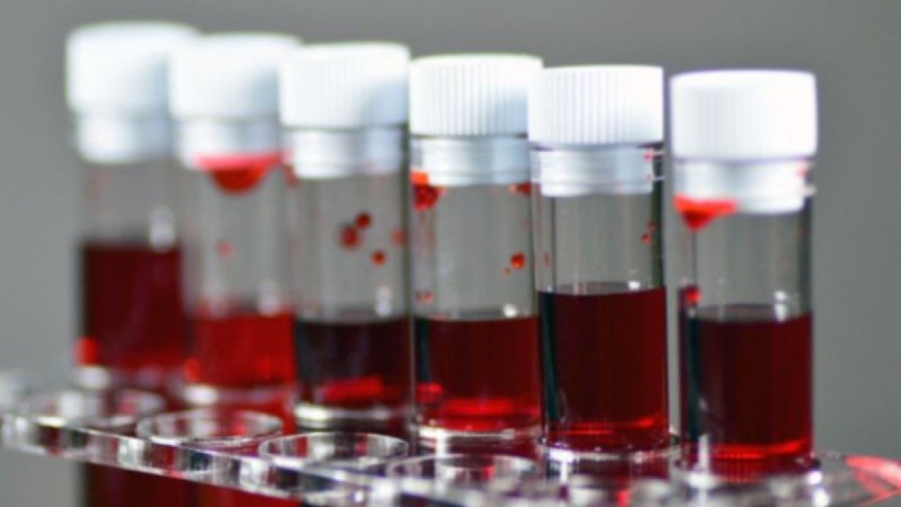 En zor Bulunan Kan Grubu Hangisidir? Türkiye'de En Çok Hangi Kan Bulunur?