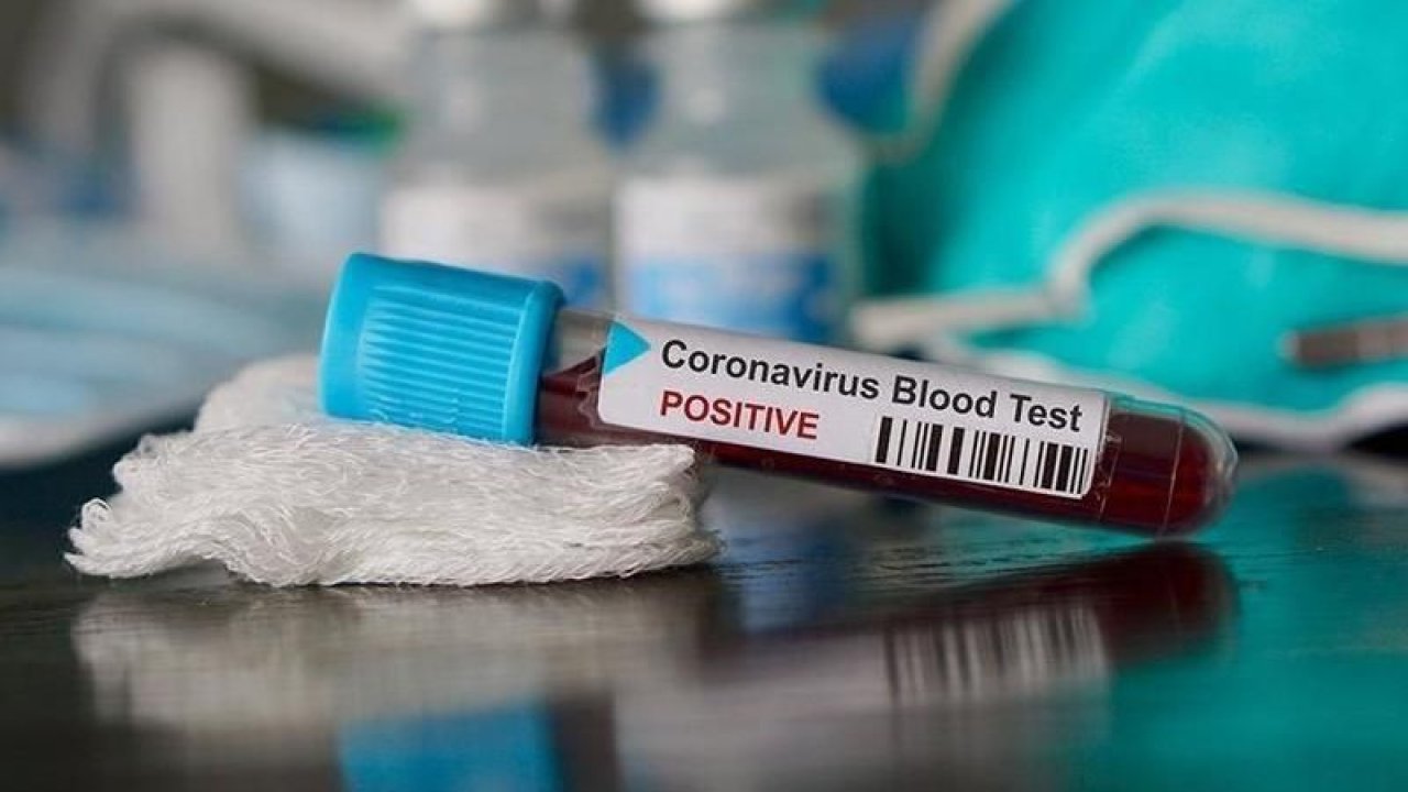 Ankara Koronavirüs Salgını Kırmızı Alarmları Çalıyor! Sağlık Bakanlığından O İllere Uyarı Geldi! Yasaklar Yeniden Gündemde mi?