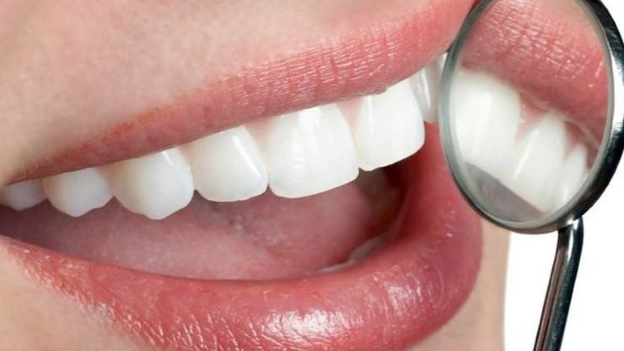 Dişleriniz Kalp Hastalığı Riskinizi Üç Kat Artırabilir!