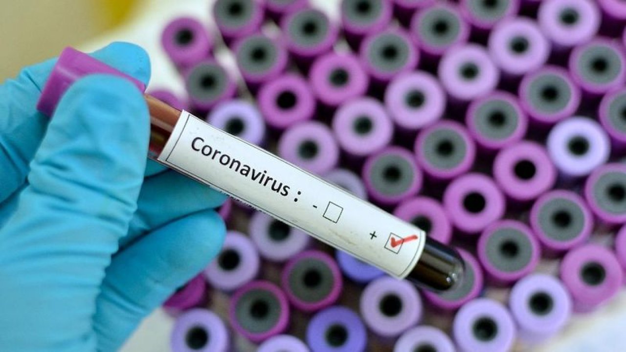 Ankara Koronavirüs Kırmızı Alarmları Çalmaya Başladı! Risk Haritası Ortaya Çıktı, Ülkede Kırmızı Olmayan Tek Bir Yer Yok! Şimdi Ne Olacak?