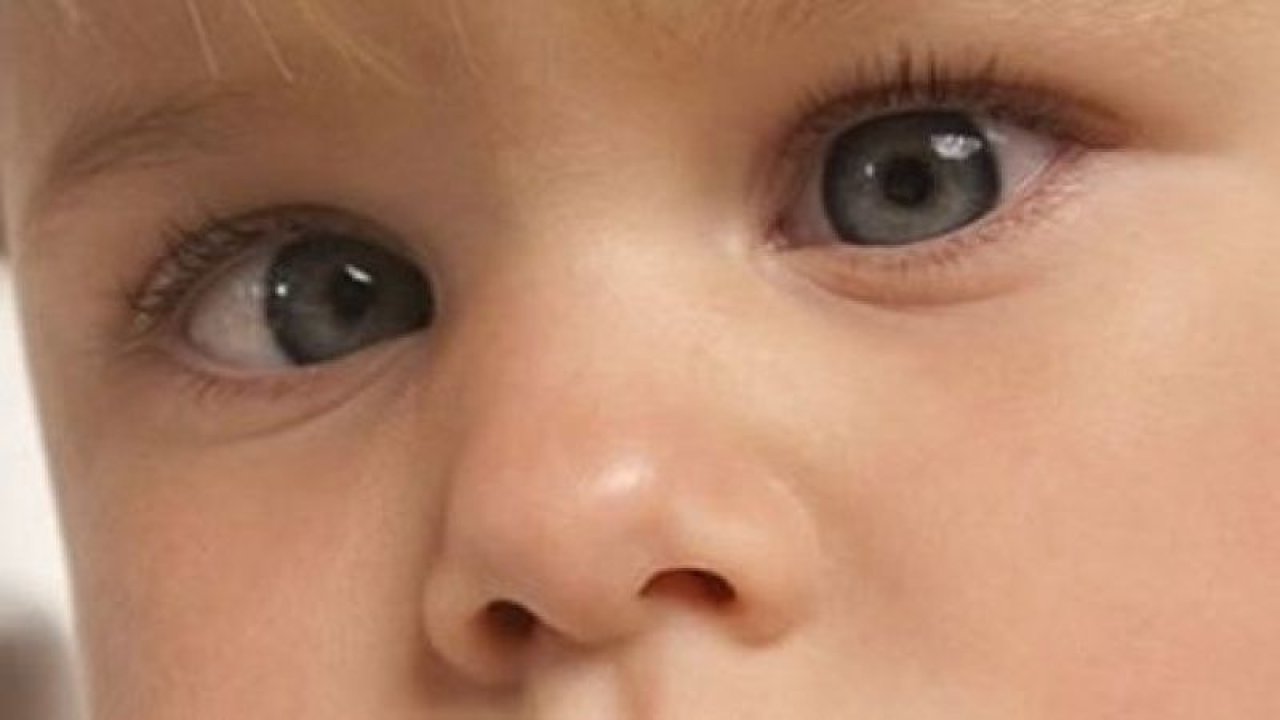 Bebekler de Göz Kaymasına Dikkat ! Bebeklerde göz kayması nasıl fark edilir?