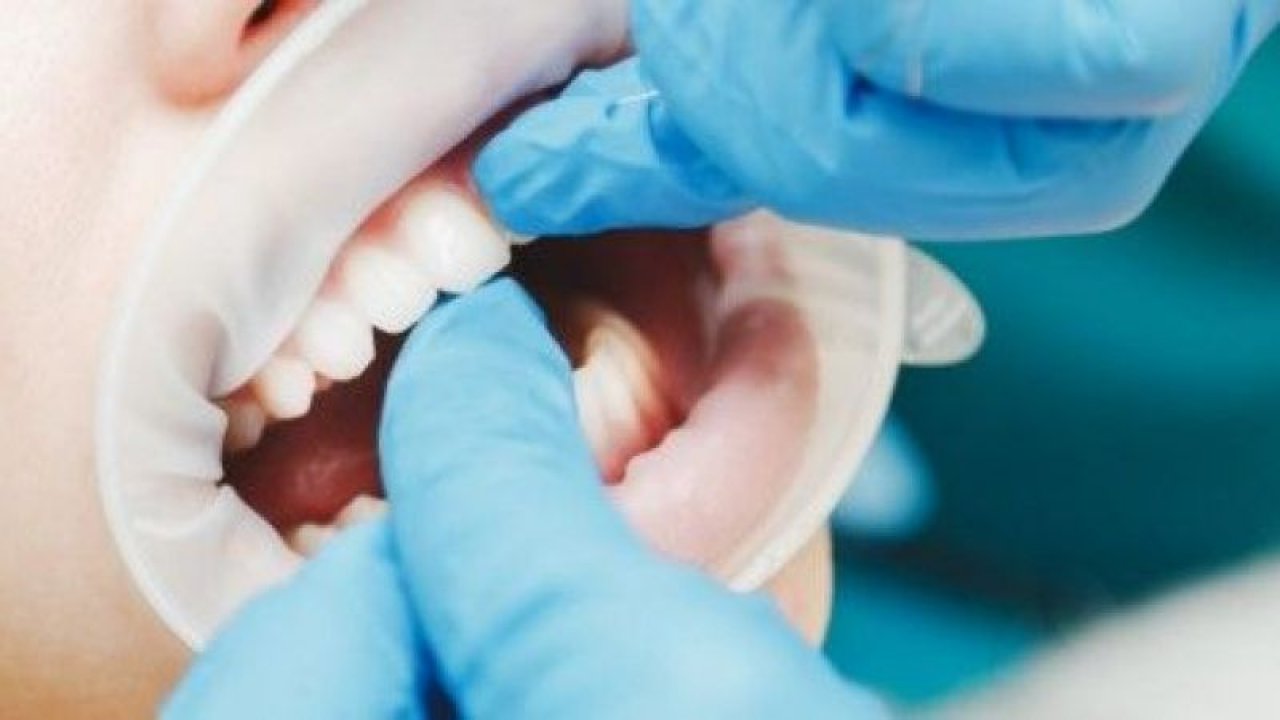Ankara Diş Hastaneleri Açık Mı? Ankara'da En İyi Diş Hastanesi Nerede?