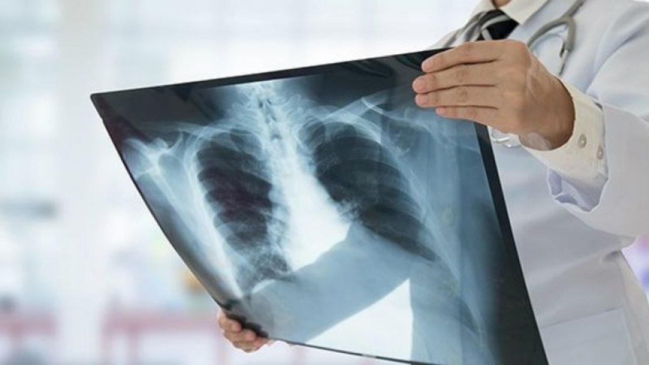 Röntgen Nedir Ne İse Yarar? Röntgen Neyi Gösterir? Röntgen Çekimi Nasıl Yapılır, Rötgeni Kim Bulmuştur?