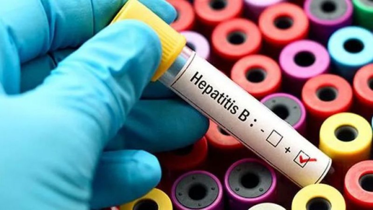 Her 30 Saniyede 1 Kişi Hepatite Bağlı Hastalıklara Yeniliyor, Hepatit Tedavisi Var Mı?