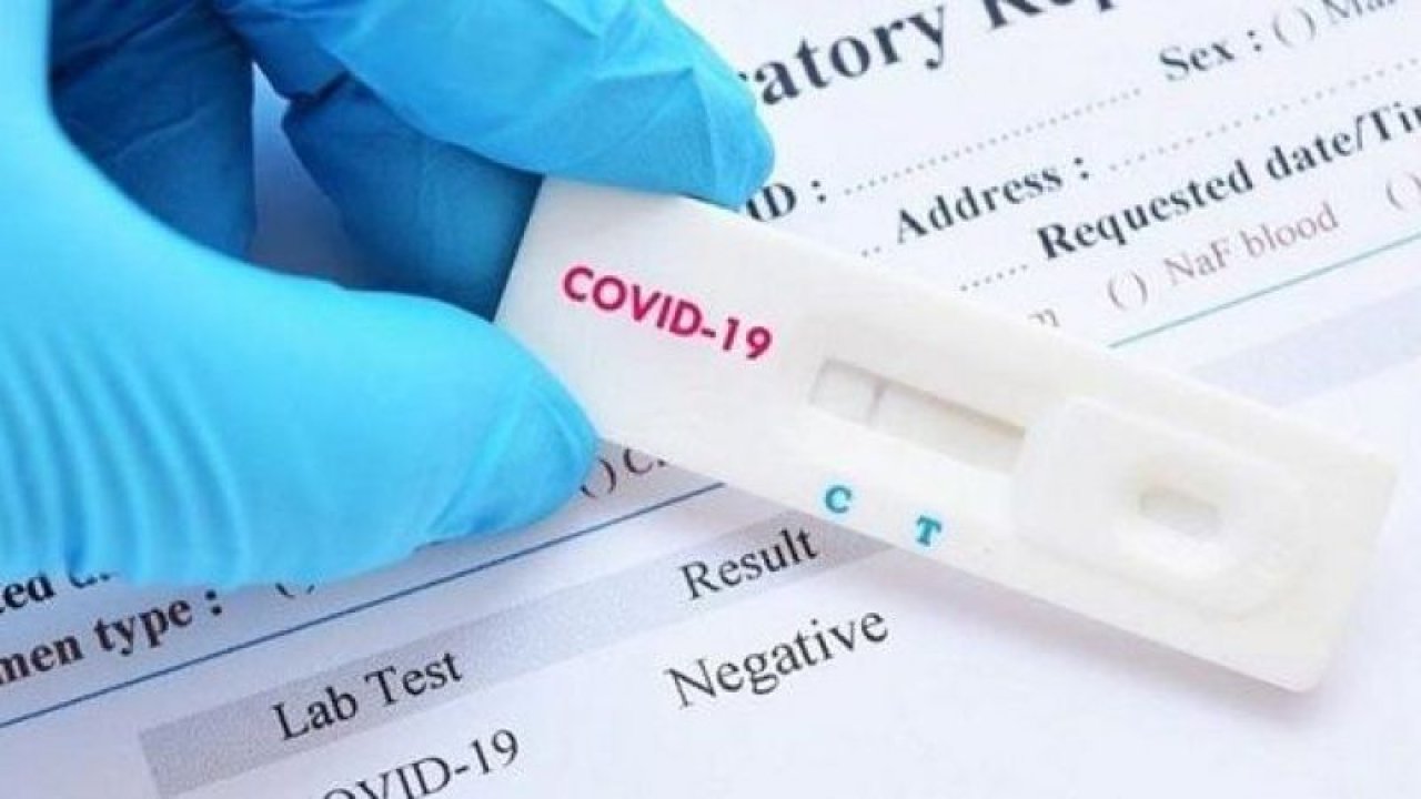 PCR Testi nedir, sonuçları ne zaman çıkar? Korona testi sonucu ne zaman çıkar? Ankara’da Covid-19 test sonucu kaç günde ve ne zaman çıkar?