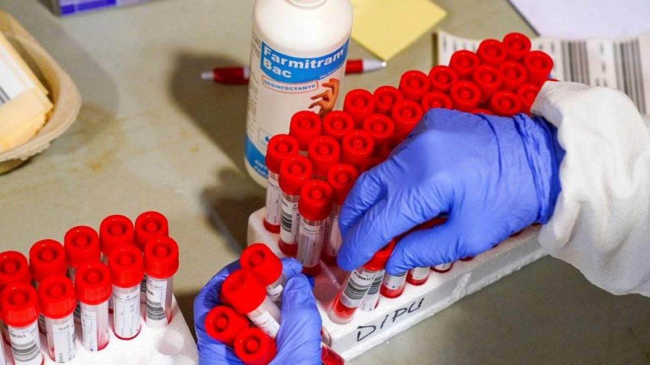 Sağlık Ocağında PCR Testi Yapılır Mı? Ankara’da Korona Testi Nerelerde Yapılır?