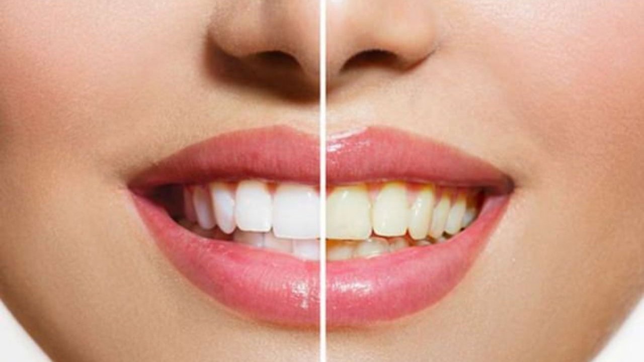 Yoğurt yemek Dişleri Beyazlatır mı? Dişlerin Beyazlaması İçin Hangi Vitamin Gerekli? İşte Dişlerinizi Beyazlatan Gıdalar!