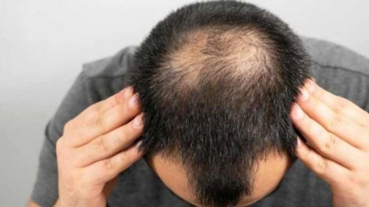 İnce ve Seyrek Saçlarınız Varsa Dikkat! Eğer Bunu Bir Kez Bile Denerseniz… Bağımlısı Olacaksınız; Saçlarınız Rapunzel’e Bin Basacak!