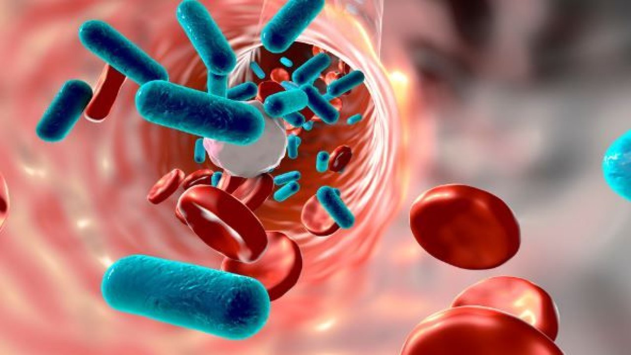 Yılda 12 Milyon Kişinin Ölümüne Neden Olan Enfeksiyon! Sebsis Nedir? Belirtileri Nelerdir? İşte ‘Sepsis’e Karşı 10 Etkili Önlem!