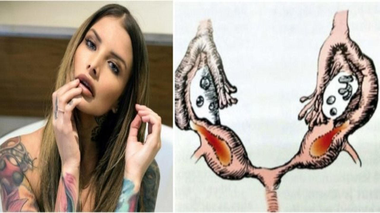 Çift Vajinası Olan Kadının İtirafı Gündem Oldu! “İki Kez Sağdan, Üçüncüyü Soldan İstiyorum"… Yok Artık!