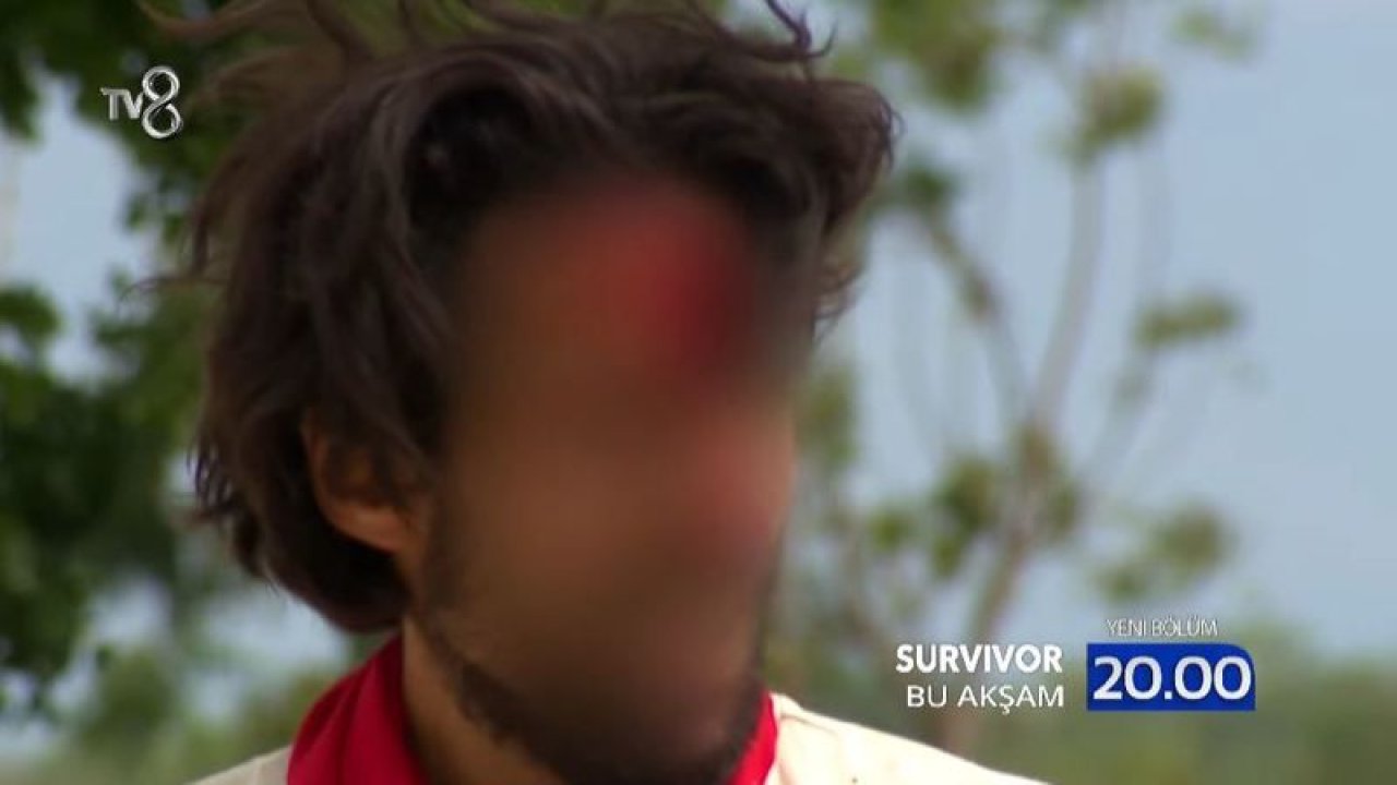 Survivor Yarışmacısı Komple Blurlandı! Acun Medya O Halini Ekranlara Getiremedi; Sağlık Durumu Yürekleri Sızlattı…