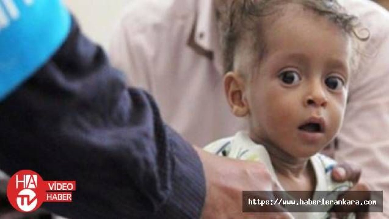 UNICEF'ten Yemen'de 2,8 milyon çocuğa aşı kampanyası