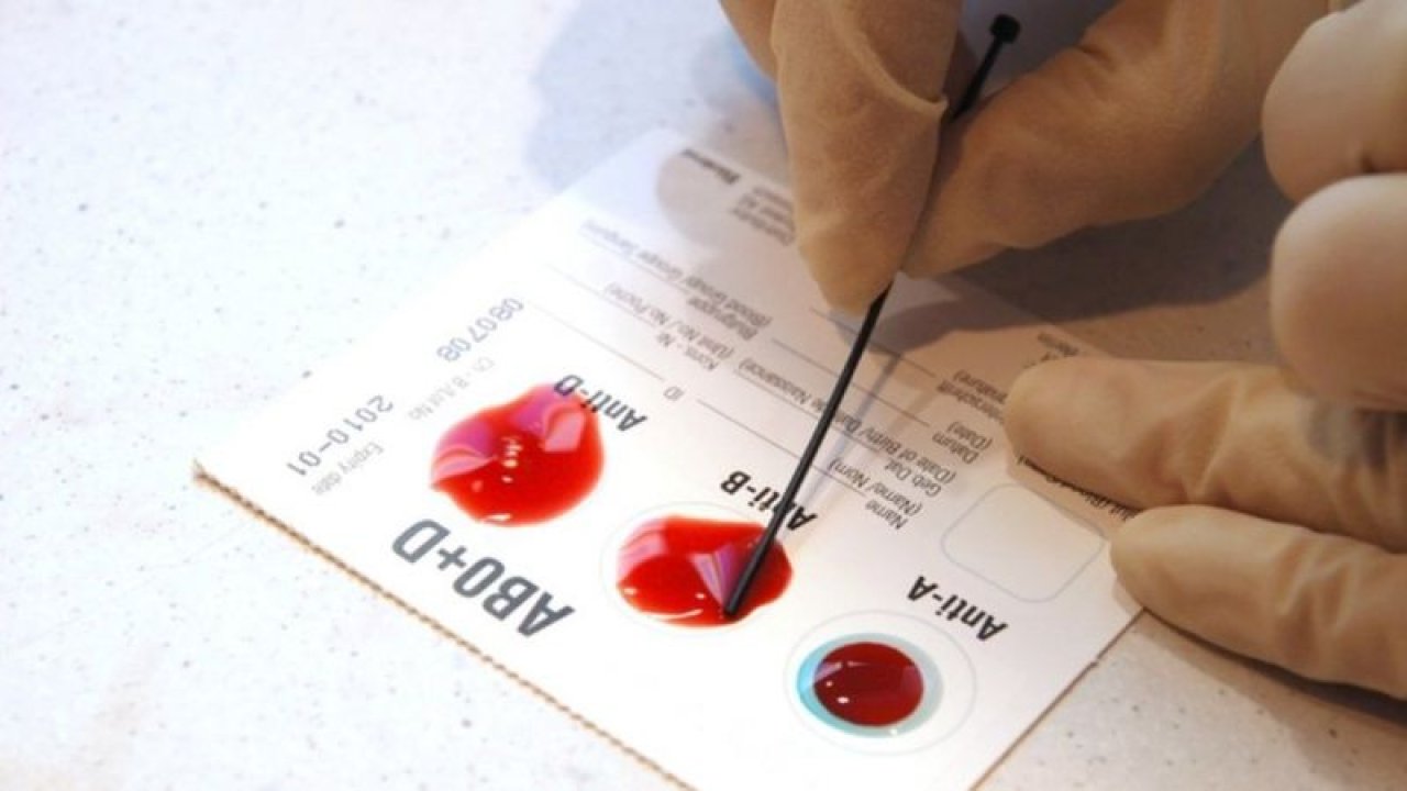 En Zeki Kan Grubu Belli Oldu! Japon Bilim İnsanları Açıkladı! Kan Grubunuz Karakterinizi Ortaya Koyuyor... O Kan Grubuna Dikkat!